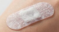 molecules penetrate skin layers