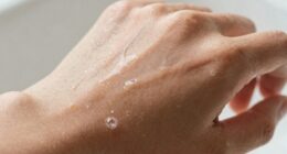 soap residue on skin